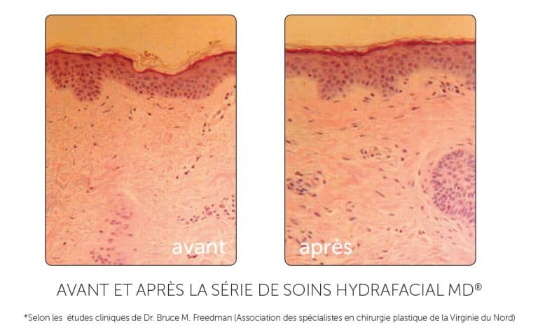 Algues Marine Institut de beauté Soin visage Hydrafacial